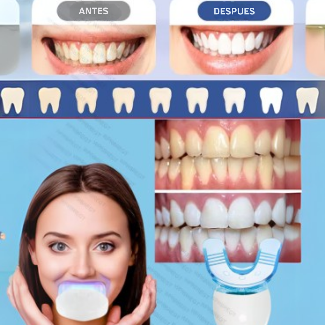 ¡SUPER OFERTA NAVIDEÑA!🎅🏻Blanqueador Dental 20 Minutos +ENVIO GRATIS (🎁🎄)